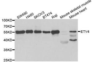 Western blot analysis of extracts of various cell lines, using ETV4 antibody. (ETV4 抗体)