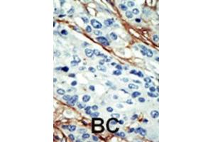 Immunohistochemistry (IHC) image for anti-NUAK Family, SNF1-Like Kinase, 1 (NUAK1) antibody (ABIN2908464) (NUAK1 抗体)