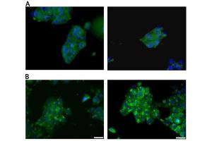 Immunocytochemistry staining of HepG2 cells (Panel A) and MCF-7 (Panel B) with Estrogen receptor alpha monoclonal antibody (C-542)  at 10μg/ml. (Estrogen Receptor alpha 抗体  (C-Term))