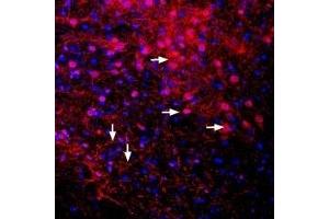 Immunohistochemistry (IHC) image for anti-Potassium Inwardly-Rectifying Channel, Subfamily J, Member 6 (KCNJ6) (AA 374-414), (Intracellular) antibody (ABIN7043488)
