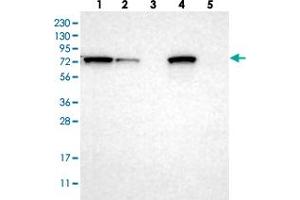 Western blot analysis of Lane 1: RT-4, Lane 2: U-251 MG, Lane 3: Human Plasma, Lane 4: Liver, Lane 5: Tonsil with HADHA polyclonal antibody  at 1:250-1:500 dilution. (HADHA 抗体)