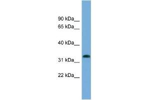 WB Suggested Anti-IFI35 Antibody Titration:  0. (IFI35 抗体  (N-Term))
