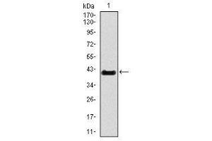 Image no. 1 for anti-T Brachyury Protein antibody (ABIN1491210) (T Brachyury Protein 抗体)