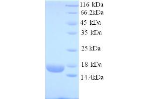 SDS-PAGE (SDS) image for Ropporin, Rhophilin Associated Protein 1B (ROPN1B) (AA 1-120) protein (His tag) (ABIN5713796) (ROPN1B Protein (AA 1-120) (His tag))