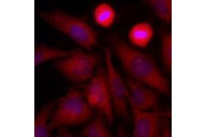 Immunofluorescence of human HeLa cells stained with Hoechst 3342 (Blue) for nucleus staining and monoclonal anti-human GAPDH antibody (1:500) with Texas Red (Red).
