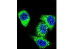 Confocal immunofluorescent analysis of TOP2A Antibody (C-term) with Hela cell followed by Alexa Fluor 488-conjugated goat anti-rabbit lgG (green). (Topoisomerase II alpha 抗体  (C-Term))
