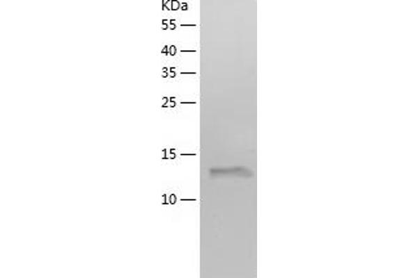 C7orf49 Protein (AA 1-157) (His tag)