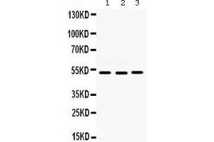 Western blot analysis of Cdc25C expression in HELA whole cell lysates (lane 1), SW620 whole cell lysates (lane 2) and MCF-7 whole cell lysates (lane 3). (CDC25C 抗体  (C-Term))