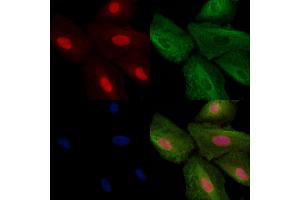 ABIN6257756 and ABIN6273652 staining  cells by IF/ICC. (IL16 抗体  (C-Term))