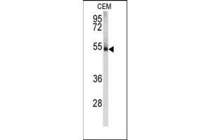Image no. 1 for anti-Protein Kinase, CAMP-Dependent, Regulatory, Type I, alpha (Tissue Specific Extinguisher 1) (PRKAR1A) (N-Term) antibody (ABIN360569)