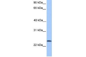 WB Suggested Anti-RP11-269F19. (TCTEX1D4 抗体  (N-Term))