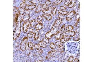 IHC analysis of KMO using anti-KMO antibody (ABIN7600958).