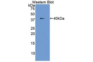 Detection of Recombinant LTF, Cattle using Polyclonal Antibody to Lactoferrin (LTF) (Lactoferrin 抗体  (AA 25-352))
