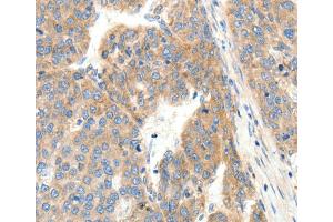 Immunohistochemistry (IHC) image for anti-Collagen, Type IV, alpha 1 (COL4A1) antibody (ABIN2431191) (COL4A1 抗体)