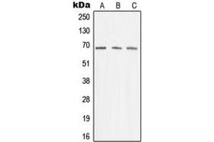 Western blot analysis of Menin expression in K562 (A), Jurkat (B), A431 (C) whole cell lysates. (Menin 抗体  (Center))