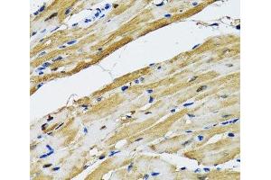Immunohistochemistry of paraffin-embedded Rat heart using GOT1 Polyclonal Antibody at dilution of 1:100 (40x lens). (GOT1 抗体)