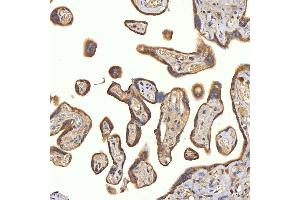 IHC analysis of SRPRA using anti-SRPRA antibody (ABIN7601408). (SRPRA (AA 346-638) 抗体)