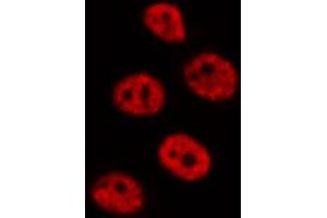 ABIN6272345 staining RAW264. (DUSP4 抗体  (Internal Region))