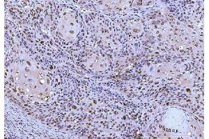 IHC analysis of Cdk2 using anti-Cdk2 antibody (ABIN7602523).