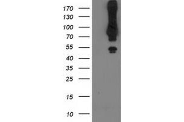 Mahogunin RING Finger Protein 1 抗体