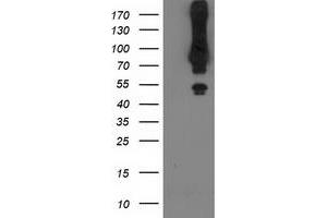 Western Blotting (WB) image for anti-Mahogunin, Ring Finger 1 (MGRN1) antibody (ABIN1499459) (Mahogunin RING Finger Protein 1 抗体)