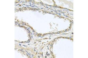 Immunohistochemistry of paraffin-embedded human prostate using TNFRSF10A antibody. (TNFRSF10A 抗体  (AA 269-468))