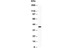 Western blot testing of SIRT3 antibody and recombinant human protein (0. (SIRT3 抗体  (AA 66-399))