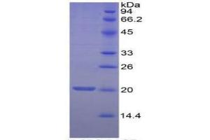 SDS-PAGE (SDS) image for Myelin Oligodendrocyte Glycoprotein (MOG) ELISA Kit (ABIN6730896)