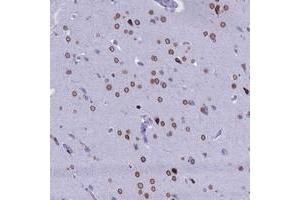 Immunohistochemical staining of human cerebral cortex with FAM169A polyclonal antibody  at 1:200-1:500 dilution. (FAM169A 抗体)