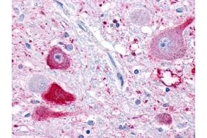 Immunohistochemical staining of Brain (Neurons) using anti- NPFFR1 antibody ABIN122333 (NPFFR1 抗体)