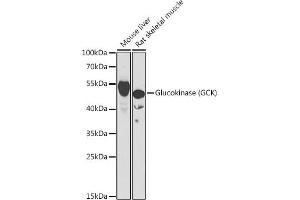 Western blot analysis of extracts of various cell lines, using Glucokinase (Glucokinase (GCK)) antibody (ABIN6131694, ABIN6141012, ABIN6141013 and ABIN6221893) at 1:1000 dilution. (GCK 抗体  (AA 1-300))