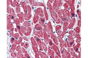 Anti-TNNI3 / CTnI antibody IHC of human heart.