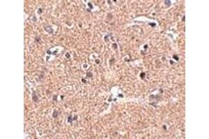 Immunohistochemistry of GALNT10 in human brain tissue with GALNT10 antibody at 2. (GALNT10 抗体  (N-Term))