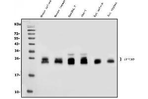 Western blot analysis of GILT/IFI30 using anti-GILT/IFI30 antibody (ABIN7601299).