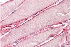 Image no. 2 for anti-Sarcoglycan, delta (35kDa Dystrophin-Associated Glycoprotein) (SGCD) (AA 244-256) antibody (ABIN1496154) (SGCD 抗体  (AA 244-256))