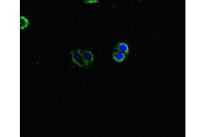 Immunofluorescent analysis of HepG2 cells using ABIN7157008 at dilution of 1:100 and Alexa Fluor 488-congugated AffiniPure Goat Anti-Rabbit IgG(H+L) (Inversin 抗体  (AA 1-101))