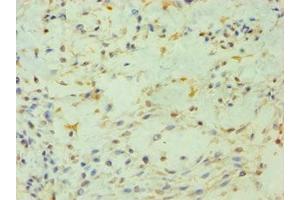 Immunohistochemistry (IHC) image for anti-Phosphatidylinositol-5-Phosphate 4-Kinase, Type II, beta (PIP4K2B) (AA 1-270) antibody (ABIN7163201)