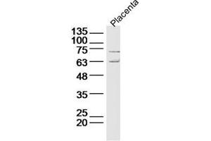 Lane 1: Mouse placenta lysate probed with Deltex 1 Polyclonal Antibody Unconjugated  at 1:300 overnight at 4˚C. (Deltex Homolog 1 抗体  (AA 351-450))