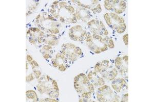Immunohistochemistry (Paraffin-embedded Sections) (IHC (p)) image for anti-Protein Phosphatase 1, Catalytic Subunit, gamma Isoform (PPP1CC) (AA 1-323) antibody (ABIN1682257)
