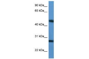 WB Suggested Anti-TM2D2 Antibody Titration: 0. (TM2D2 抗体  (Middle Region))