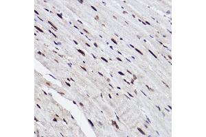 Immunohistochemistry of paraffin-embedded mouse heart using GTF2I Rabbit mAb (ABIN1682306, ABIN3015201, ABIN3015202 and ABIN7101319) at dilution of 1:100 (40x lens). (GTF2I 抗体)