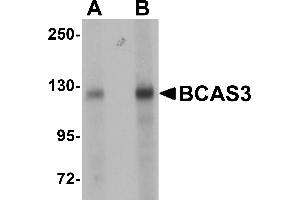 Western Blotting (WB) image for anti-Breast Carcinoma Amplified Sequence 3 (BCAS3) (N-Term) antibody (ABIN1031263) (BCAS3 抗体  (N-Term))