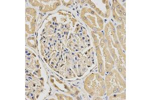 Immunohistochemistry (IHC) image for anti-HUS1 Checkpoint Homolog (S. Pombe) (HUS1) antibody (ABIN1876595) (HUS1 抗体)