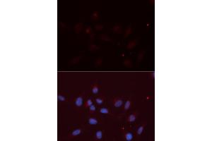Immunofluorescence (IF) image for anti-Amyloid beta (A4) Precursor-Like Protein 2 (APLP2) antibody (ABIN1876643) (APLP2 抗体)