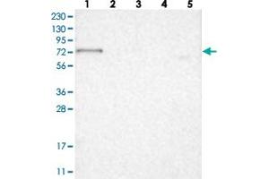 Western blot analysis of Lane 1: RT-4, Lane 2: U-251 MG, Lane 3: Human Plasma, Lane 4: Liver, Lane 5: Tonsil with RUNDC1 polyclonal antibody  at 1:250-1:500 dilution. (RUNDC1 抗体)