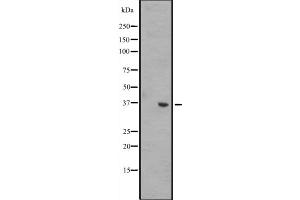 Western blot analysis of WNT8B expression in A431 whole cell lysate ,The lane on the left is treated with the antigen-specific peptide. (WNT8B 抗体  (Internal Region))