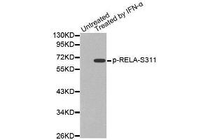 Western blot analysis of extracts from Hela cells, using Phospho-RELA-S311 antibody. (NF-kB p65 抗体  (pSer311))