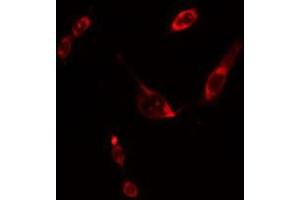 ABIN6275599 staining Hela cells by IF/ICC. (SOS2 抗体  (Internal Region))