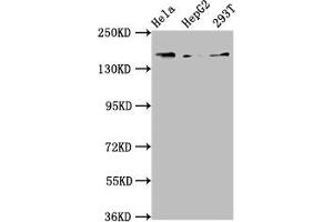 Western Blot Positive WB detected in: Hela whole cell lysate, HepG2 whole cell lysate, 293T whole cell lysate All lanes: C4A antibody at 3. (C4A 抗体  (AA 1027-1186))