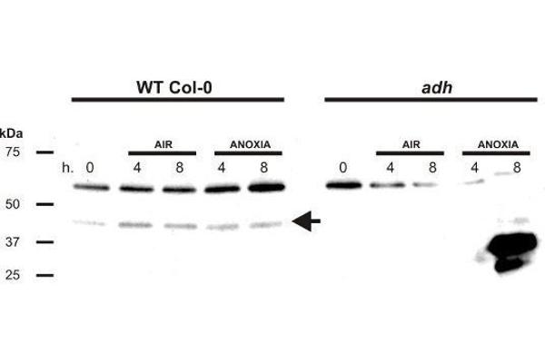 Alcohol Dehydrogenase (ADH) 抗体